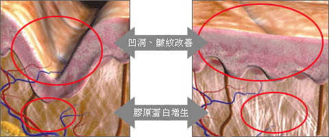 二氧化碳雷射,雷射门诊