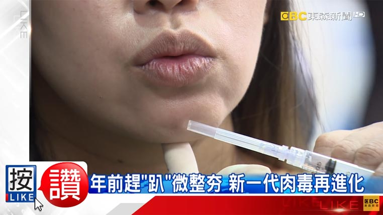 肉毒杆菌疗程